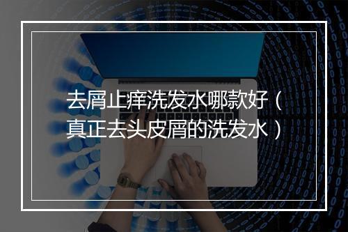 去屑止痒洗发水哪款好(真正去头皮屑的洗发水)