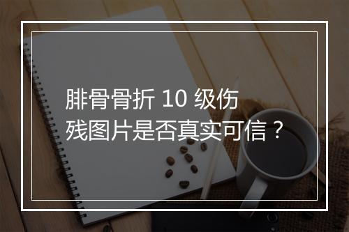 腓骨骨折 10 级伤残图片是否真实可信?